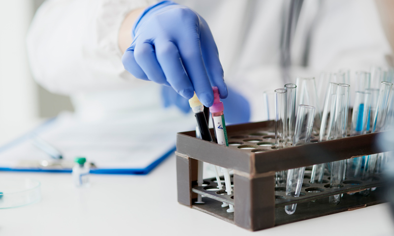 Paternity-in-Utah-Blog Scientific Test Tubes